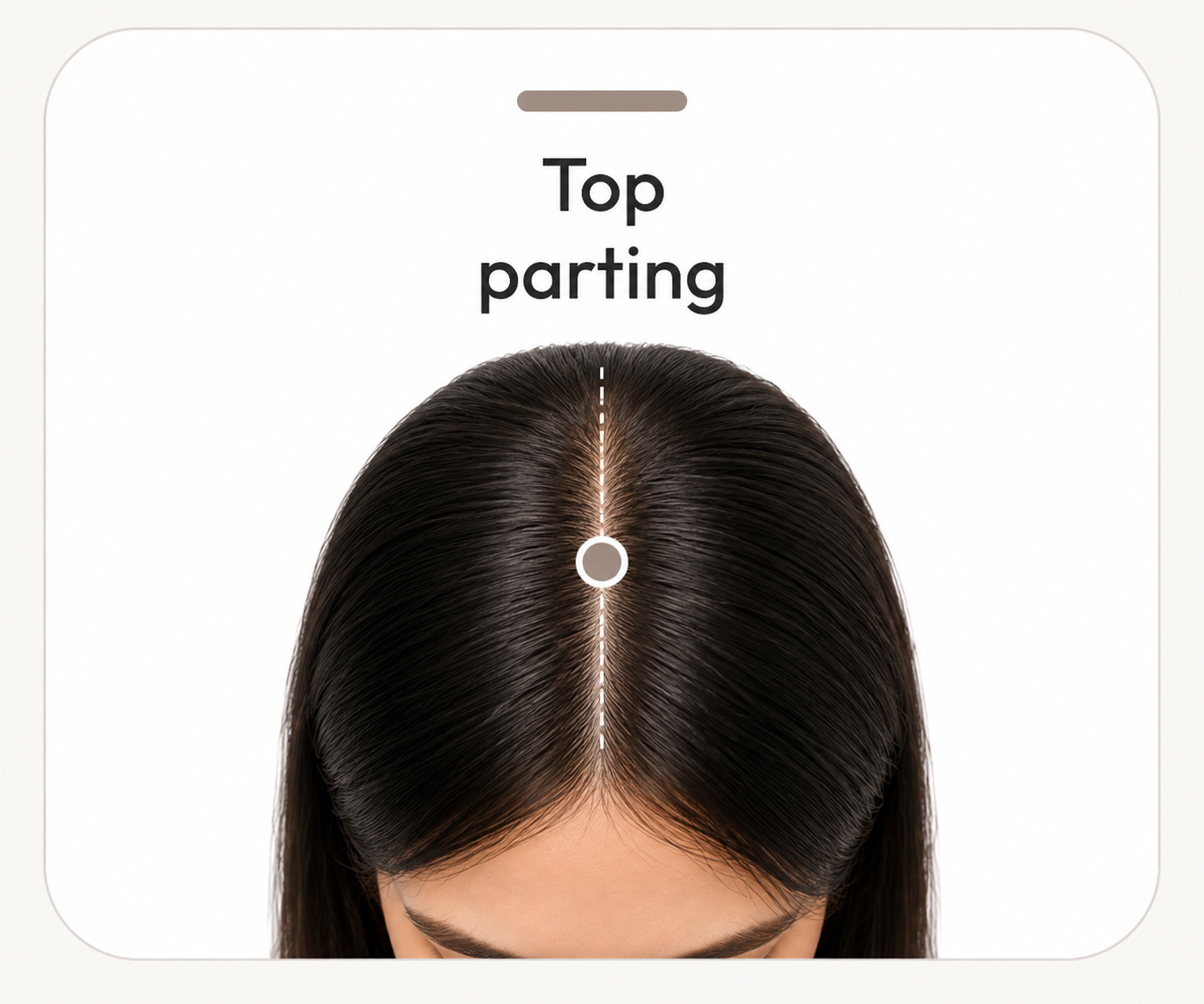 Top view of a head with the central top parting marked as the second scalp-magnification assessment point.