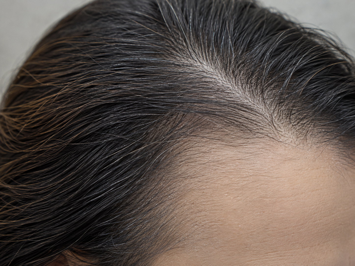 Close view of the same client's hairline or temporal region showing a more matte appearance with fine visible scale.